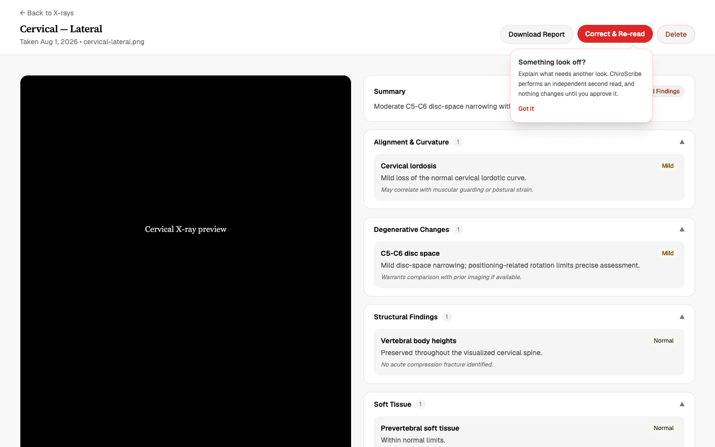 X-ray analysis page in ChiroScribe showing the Correct & Re-read button above the AI analysis sections