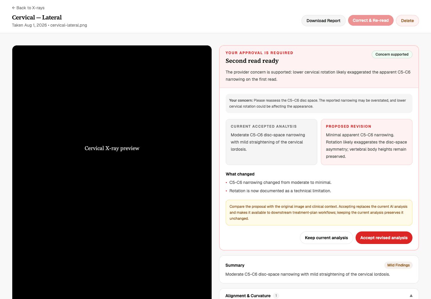 Second read results comparing the current accepted analysis and the proposed revision side by side with the concern assessment and Keep current analysis and Accept revised analysis buttons