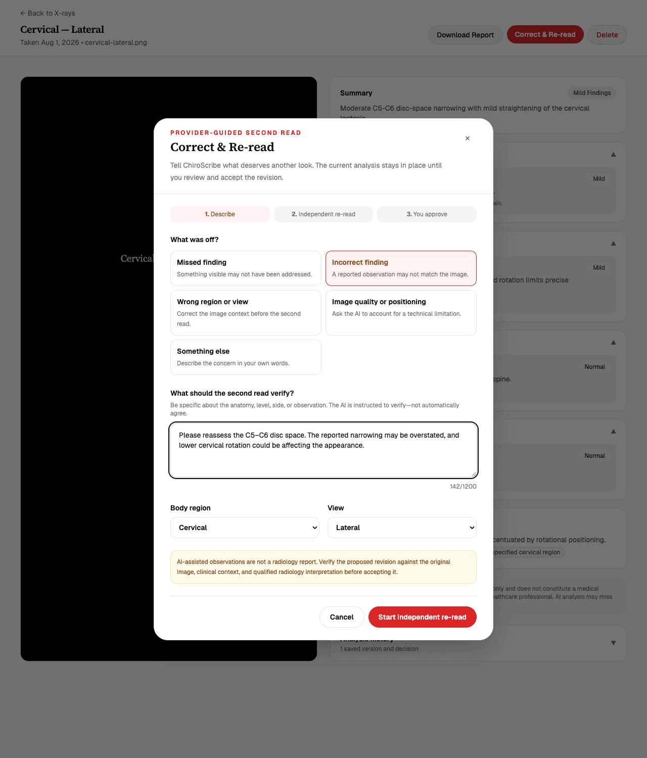 Correct & Re-read dialog with reason choices, a provider concern text field, and body region and view selection